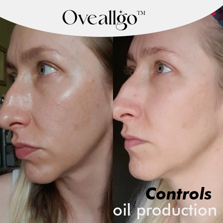 Oveallgo™ Brightening Skin Herbal Exfoliating Gel